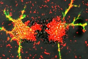 White blood cells reengineered by Batrakova deliver exosomes loaded with proteins that stimulate the growth of damaged nerve fibers